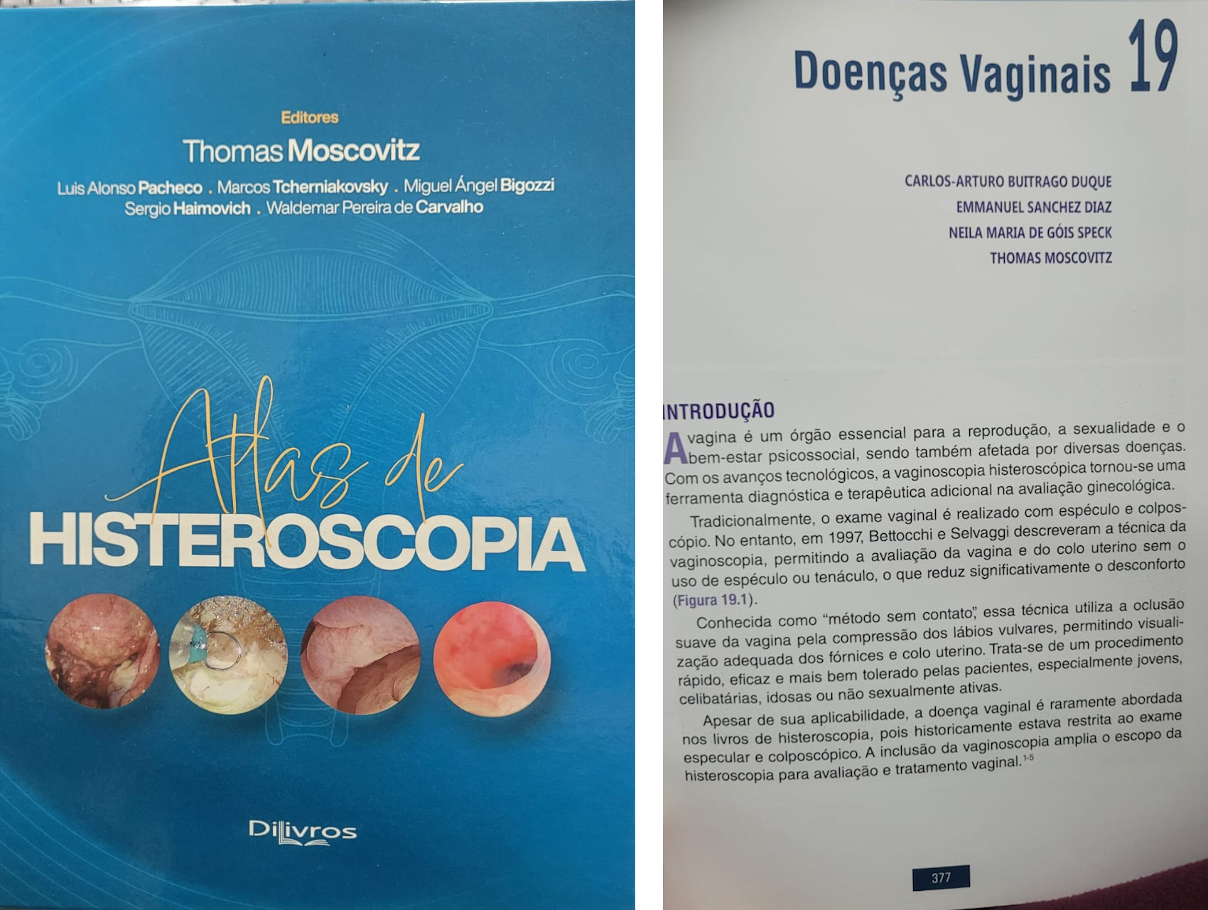 Endogine, Dr Carlos Buitrago, Atlas de la Histerescopia